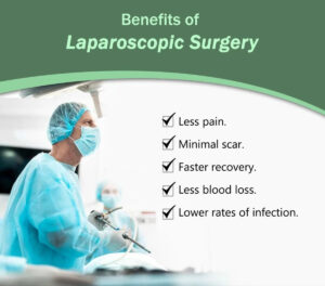 Benefits of Laparoscopic Surgery 