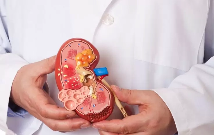  Your Kidneys Work Hard—Are You Taking Care of Them?