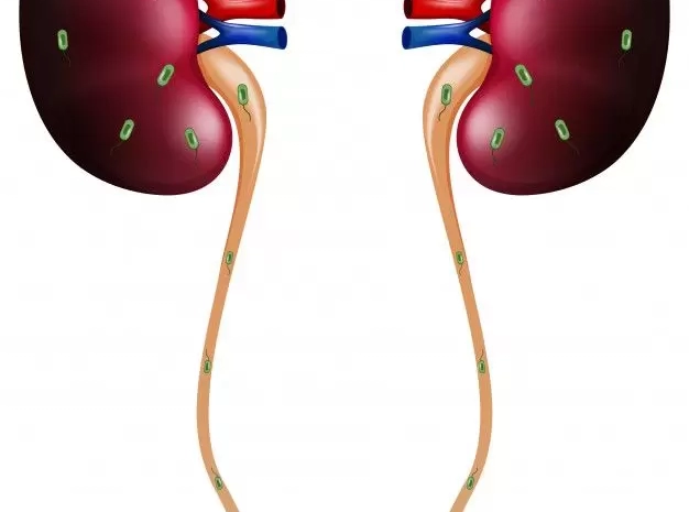  UTIs Explained: Why Women Are More at Risk and How to Stay Safe