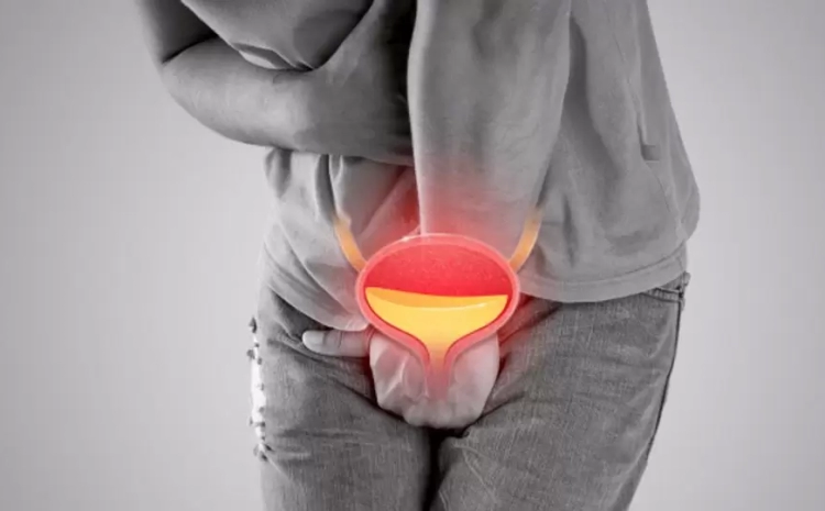  Bladder Infections: Common Causes and Simple Prevention Tips