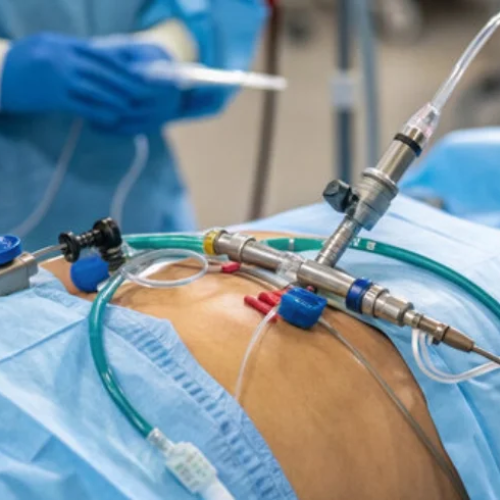 Minimally Invasive Surgery Tulip Hospital Sonipat